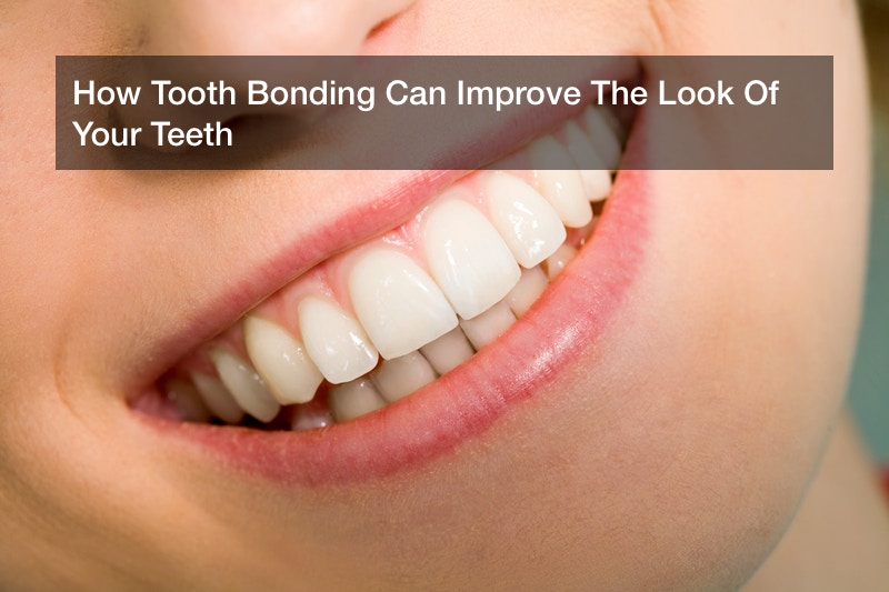 How Tooth Bonding Can Improve The Look Of Your Teeth - Culture Forum